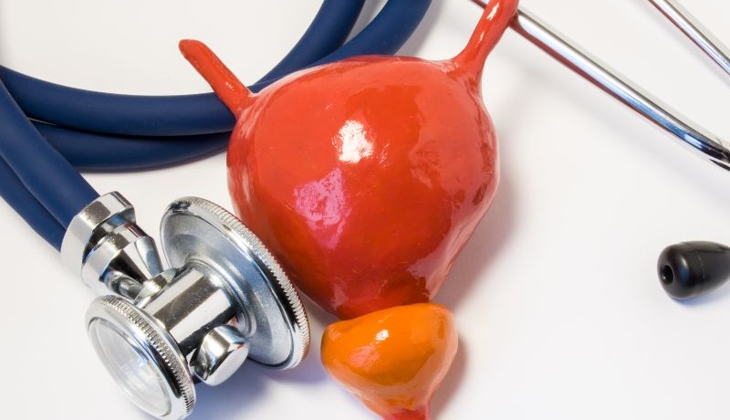 Czym jest prostata u mężczyzn i jakie są choroby prostaty? Na zdjęciu model prostaty obok stetoskopu.