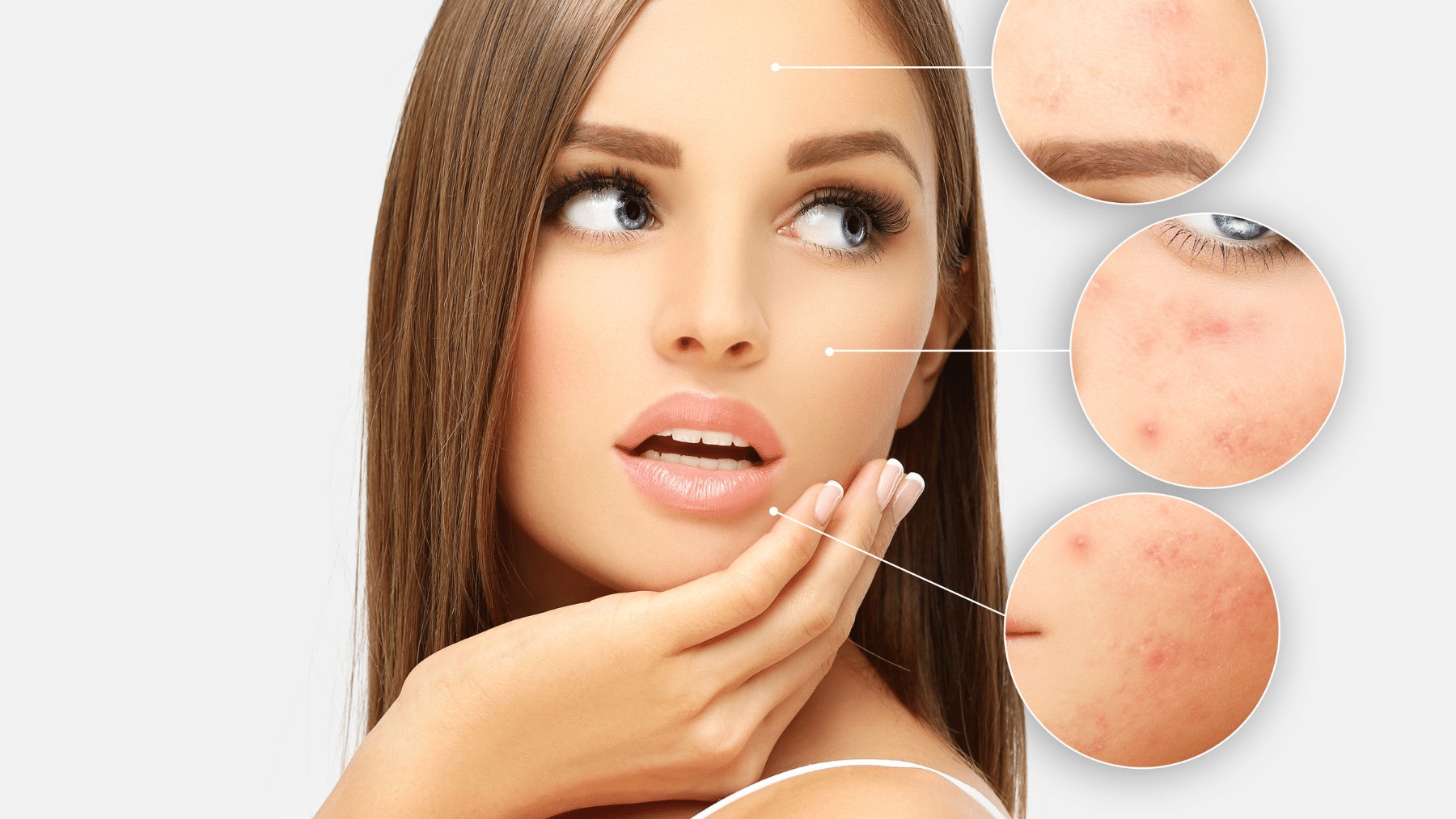 Nowotwory układu moczowo-płciowego a trądzik